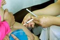 Xác định nguyên nhân bé 2 tháng tuổi tử vong sau tiêm chủng