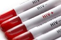 Liên Hợp Quốc: Bệnh nhân thứ hai nhiễm HIV được điều trị khỏi bệnh là bước đột phá
