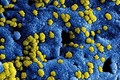 Bộ Y tế ban hành kế hoạch phòng chống bệnh viêm phổi cấp do chủng mới của vi rút corona