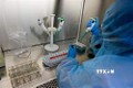新冠肺炎疫情：越南中央顺化医院能进行新冠病毒检测