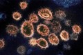 Dịch viêm đường hô hấp cấp COVID-19: Virus SARS-CoV-2 chủ yếu gây tổn thương phổi