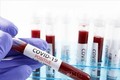 Mỹ đạt bước tiến mới trong phát hiện kháng thể chống virus SARS-CoV-2