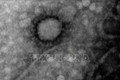 Các nhà khoa học Argentina chụp được hình ảnh virus SARS-CoV-2 ﻿