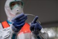 Nhật Bản cho phép xét nghiệm virus SARS-CoV-2 qua nước bọt