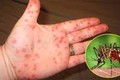 Phát hiện vi khuẩn có khả năng tiêu diệt muỗi mang mầm bệnh sốt xuất huyết