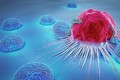 Phương pháp mới giúp tăng cường hiệu quả của liệu pháp miễn dịch trong điều trị ung thư