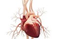 Tìm hiểu cơ chế gây bệnh tim bẩm sinh do phơi nhiễm cadmium
