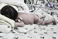 Thành phố Hồ Chí Minh: Phối hợp sản - nhi phẫu thuật thành công bướu quái khổng lồ ở trẻ sơ sinh