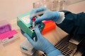 越南成功研发两款新冠病毒核酸检测试剂盒