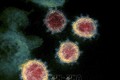 Hình ảnh nhìn qua kính hiển vi cho thấy virus SARS-CoV-2 (vật thể tròn màu xanh) nổi lên trên bề mặt tế bào bệnh nhân nhiễm COVID-19. Ảnh: AFP/TTXVN