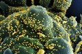 Hình ảnh quét qua kính hiển vi điện tử cho thấy một tế bào (màu xanh) bị virus SARS-COV-2 (màu vàng) xâm nhập, lấy từ mẫu bệnh phẩm của bệnh nhân COVID-19 tại Viện Nghiên cứu Dị ứng và Bệnh Truyền nhiễm Quốc gia, Fort Detrick, Maryland, Mỹ ngày 15/7/2020.