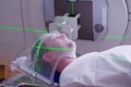 Phương pháp điều trị mới mang lại hy vọng cho bệnh nhân bị ung thư vùng đầu cổ