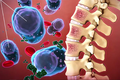 Phương thức điều trị bệnh đa u tủy xương mới dựa trên công nghệ RNA