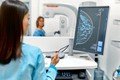 AI có thể giúp giảm gần 50% khối lượng công việc của các bác sỹ chẩn đoán hình ảnh trong tầm soát và phát hiện dấu hiệu ung thư vú. Ảnh: Cancerresearchuk