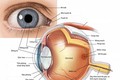 Các dấu hiệu ở mắt cho phép phát hiện các rối loạn về thần kinh