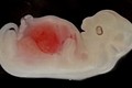 Các nhà khoa học nuôi cấy thành công thận chứa tế bào người trong phôi thai lợn