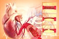 Đột biến gene tạo máu liên quan đến bệnh tim