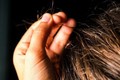 Bác sĩ khuyến cáo cách phát hiện, xử lý hành vi tự ăn tóc ở trẻ em