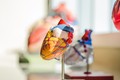 Australia chế tạo trái tim nhân tạo tiên tiến nhất trên thế giới