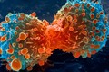 Theo nhóm nghiên cứu, khối u lây lan do các nhóm hormone được sản xuất với số lượng lớn khi cơ thể rơi vào tình trạng căng thẳng. Ảnh: news.leportale.com
