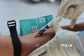 Tại Đà Nẵng, việc lấy mẫu xét nghiệm cho người nước ngoài được thực hiện bằng phương pháp là huyết thanh học (ELISA). Ảnh: Văn Dũng - TTXVN