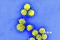 Hình ảnh quét qua kính hiển vi điện tử cho thấy virus SARS-COV-2 lấy từ mẫu bệnh phẩm của bệnh nhân COVID-19 tại Viện Nghiên cứu Dị ứng và Bệnh Truyền nhiễm Quốc gia, Fort Detrick, Maryland, Mỹ ngày 11/8/2020. Ảnh: AFP/TTXVN