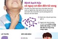 Phòng tránh bệnh bạch hầu. Ảnh : infographics.vn