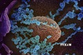Virus SARS-CoV-2 (màu xanh) trên bề mặt các tế bào lấy từ mẫu bệnh phẩm của một bệnh nhân nhiễm COVID-2 tại Mỹ. Ảnh: AFP/TTXVN