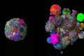Mô hình 3D cho thấy khối u phát triển và biến đổi như thế nào theo thời gian.Ảnh: genk.vn
