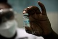 Nhân viên y tế giới thiệu vaccine Abdala ngừa COVID-19 của Cuba. Ảnh: AFP/TTXVN
