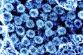 Hình ảnh từ kính hiển vi do Viện nghiên cứu bệnh truyền nhiễm và dị ứng quốc gia Mỹ cung cấp cho thấy các phần tử virus SARS-CoV-2 trong mẫu bệnh phẩm của bệnh nhân mắc COVID-19. Ảnh: AFP/TTXVN  
