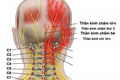 Đau dây thần kinh chẩm là một nguyên nhân phổ biến gây đau đầu. Ảnh : vinmec.com
