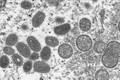 Hình ảnh virus đậu mùa khỉ dưới kính hiển vi điện tử. Ảnh: AFP/TTXVN
