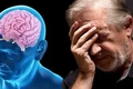 Hợp chất mới giúp điều trị bệnh Alzheimer