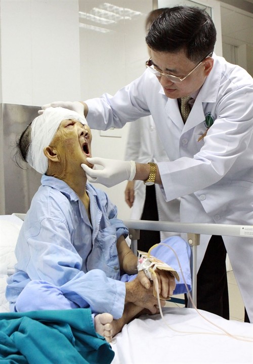 Viện Răng - Hàm - Mặt Trung ương phẫu thuật thành công khối u khổng lồ nặng 3 kg trên mặt
