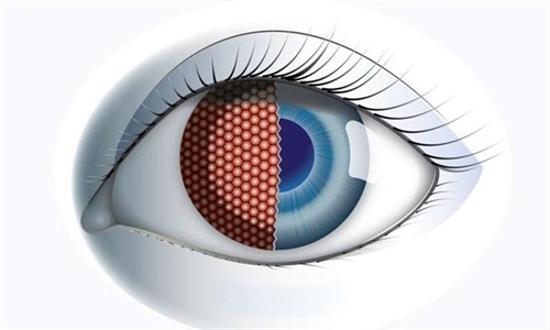 Thụy Sĩ nghiên cứu chế tạo mắt ruồi nhân tạo