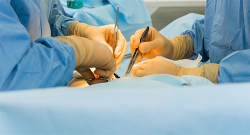 Phẫu thuật cấy ghép đầu người có thể được thực hiện tại Việt Nam