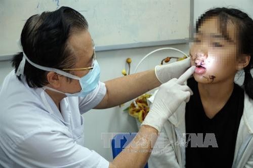 Thành phố Hồ Chí Minh: Ngã vào cửa kính lớp học, một bé gái bị tổn thương nghiêm trọng ở mặt