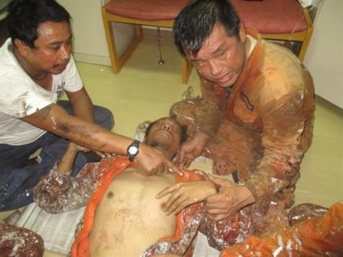 越南紧急救助一名海上病危外籍船员