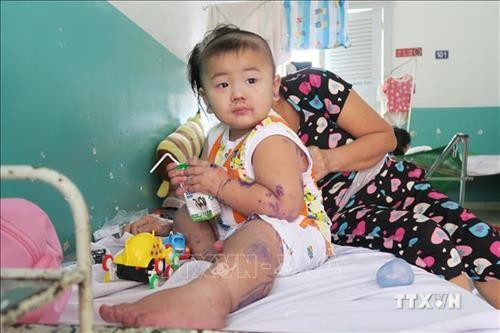 Gia tăng trẻ bị bệnh tay chân miệng tại Thành phố Hồ Chí Minh