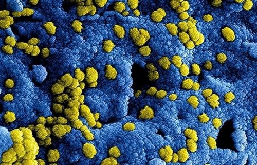 Bộ Y tế ban hành kế hoạch phòng chống bệnh viêm phổi cấp do chủng mới của vi rút corona