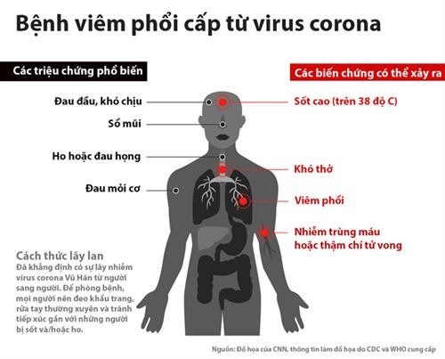 Bổ sung bệnh viêm đường hô hấp cấp do chủng mới của virus corona gây ra vào danh mục các bệnh truyền nhiễm nhóm A