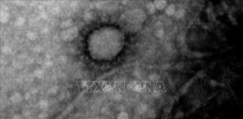 Các nhà khoa học Argentina chụp được hình ảnh virus SARS-CoV-2 ﻿