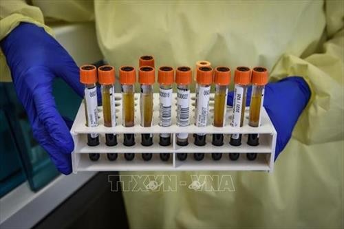 Italy thử nghiệm thành công kháng thể chống virus SARS-CoV-2 