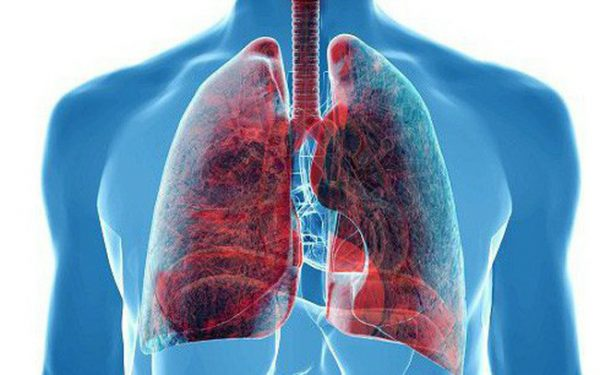  Phát triển phương pháp điều trị ung thư phổi mới đầy hứa hẹn