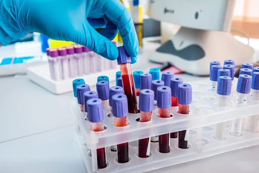 Israel phát triển phương pháp chẩn đoán nhiều bệnh từ một xét nghiệm máu đơn giản