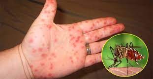 Phát hiện vi khuẩn có khả năng tiêu diệt muỗi mang mầm bệnh sốt xuất huyết
