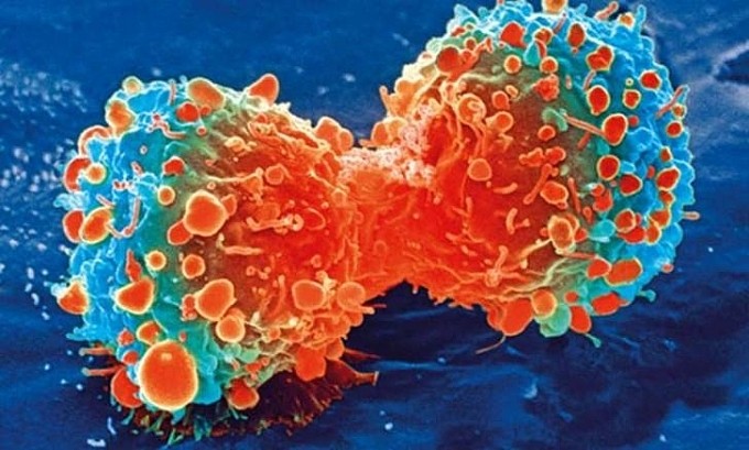 Tế bào ung thư tuyến tuỵ trong quá trình phân chia. Ảnh: cuocsongantoan.vn