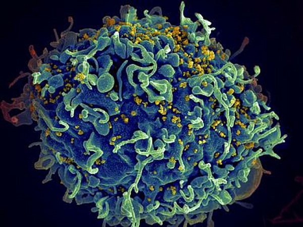 Bắt đầu thử nghiệm ở người vaccine ngừa HIV sử dụng công nghệ mRNA