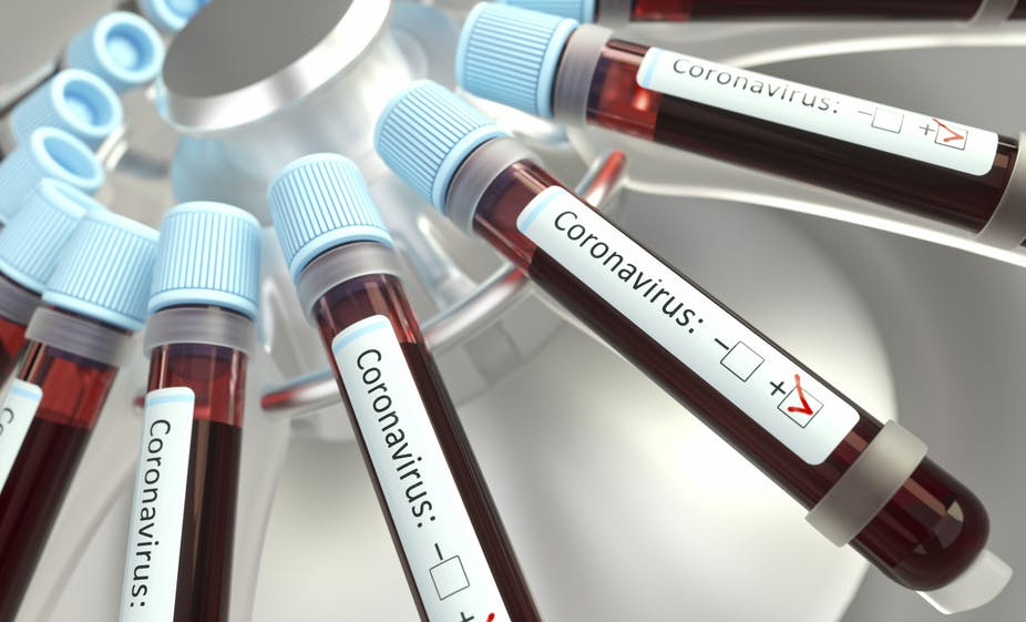 Liên quan giữa nhóm máu và mức độ nghiêm trọng khi mắc COVID-19